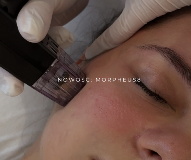 NOWOŚĆ MORPHEUS8