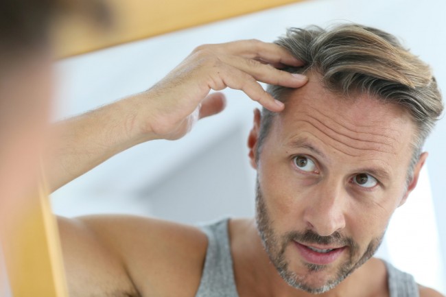 Nadmierne wypadanie włosów - Mezoterapia | VivaEstetica